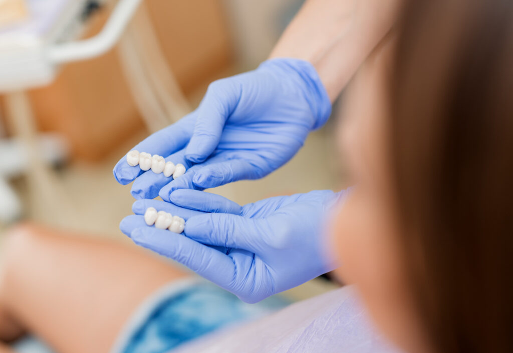 how to place your dental bridge for a natural looking smile