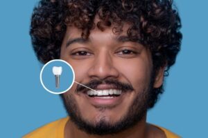 Top 7 Signs You Might Need a Dental Crown