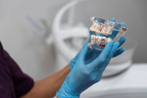 How to Care for Your Dental Implants for Long-Lasting Results