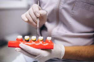 What Makes Dental Implants a Permanent Solution for Missing Teeth